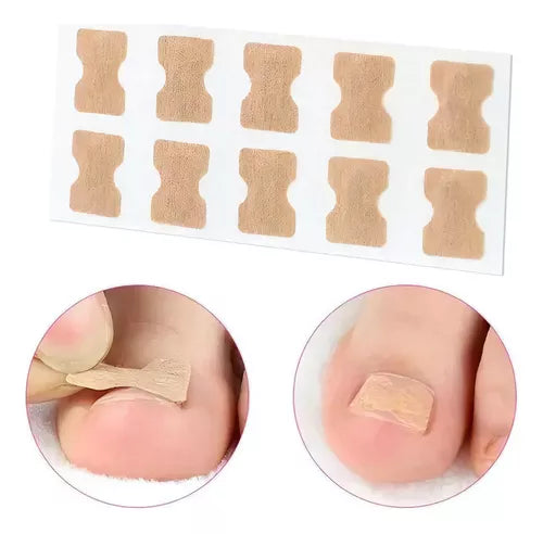Ingrown Toenails and Fungal Infections
