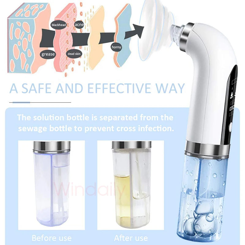HydraFacial Bubble Blackhead Remover
