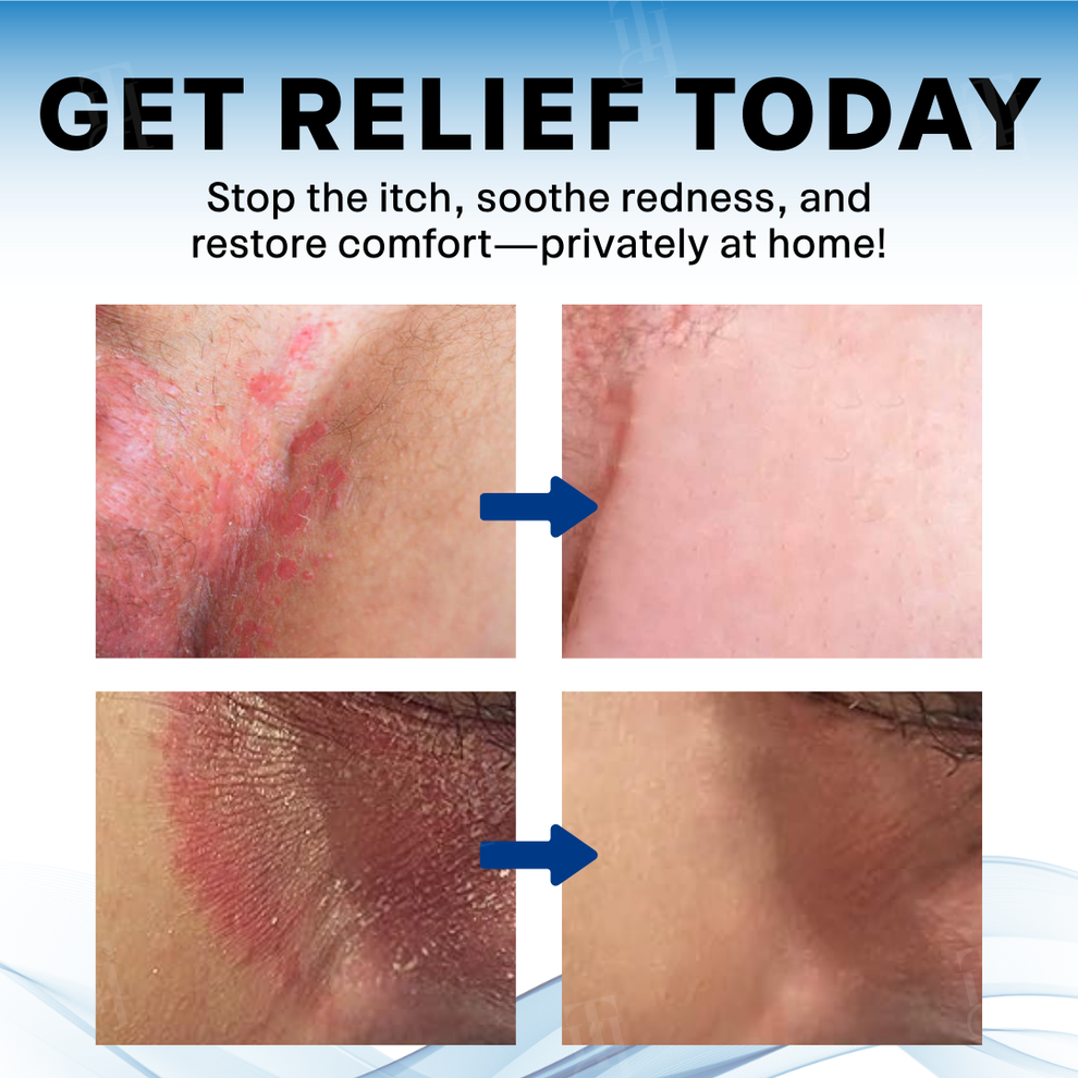 Scrotum Itchy Treatment Cream