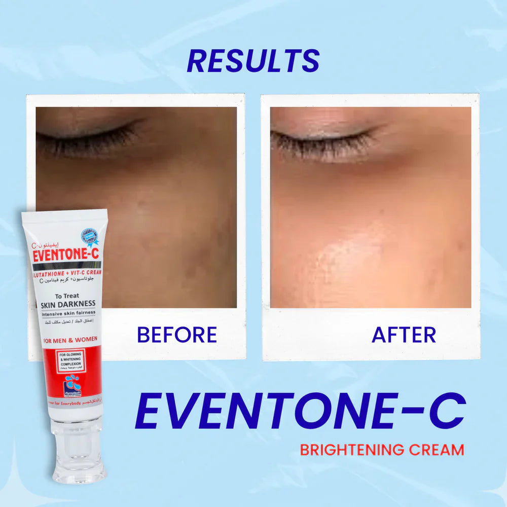 Eventone-C Cream