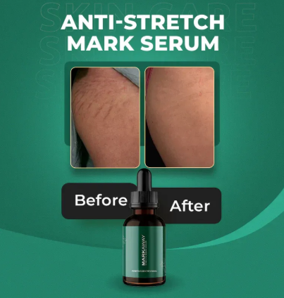 Stretch Marks Serum