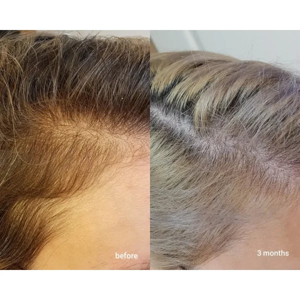 The Ordinary Multi-Peptide Serum