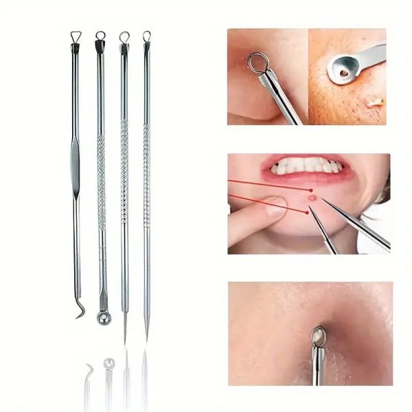 Blackhead Kit