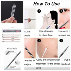 Blackhead Kit