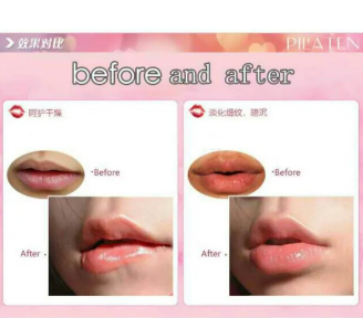 Lip Mask